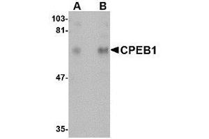 Image no. 1 for anti-Cytoplasmic Polyadenylation Element Binding Protein 1 (CPEB1) (N-Term) antibody (ABIN342681) (CPEB1 antibody  (N-Term))
