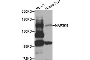 Western blot analysis of extracts of various cell lines, using MAP3K5 antibody (ABIN5970110) at 1/1000 dilution. (ASK1 antibody)