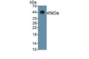 Detection of Recombinant CGRP, Mouse using Polyclonal Antibody to Calcitonin Gene Related Peptide (CGRP) (CGRP antibody  (AA 1-130))
