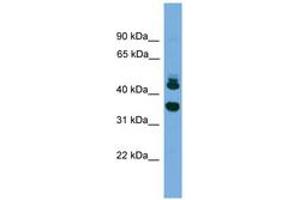 Image no. 1 for anti-Sorting Nexin 32 (SNX32) (AA 251-300) antibody (ABIN6745574) (SNX32 antibody  (AA 251-300))