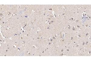 Detection of FGF13 in Human Cerebrum Tissue using Monoclonal Antibody to Fibroblast Growth Factor 13 (FGF13) (FGF13 antibody  (AA 108-227))