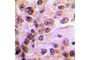 Immunohistochemistry (IHC) image for anti-Inhibitor of kappa Light Polypeptide Gene Enhancer in B-Cells, Kinase gamma (IKBKG) (pSer85) antibody (ABIN7297396)
