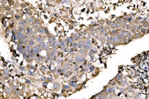 IHC analysis of EVL using anti-EVL antibody (ABIN7600986). (EVL antibody  (AA 268-400))