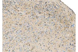 IHC analysis of Ezrin/EZR using anti-Ezrin/EZR antibody (ABIN7603214).