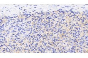Detection of CD40L in Porcine Spleen Tissue using Polyclonal Antibody to Cluster Of Differentiation 40 Ligand (CD40L) (CD40 Ligand antibody  (AA 111-261))