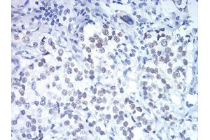 Immunohistochemistry (IHC) image for anti-DEAD (Asp-Glu-Ala-Asp) Box Polypeptide 5 (DDX5) (AA 475-614) antibody (ABIN5899181) (DDX5 antibody  (AA 475-614))