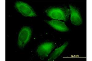 Image no. 5 for anti-Serine--tRNA Ligase, Cytoplasmic-Like (AA 1-515) antibody (ABIN598916) (Serine--tRNA Ligase, Cytoplasmic-Like (AA 1-515) antibody)