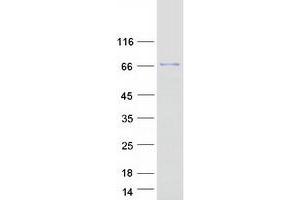 Validation with Western Blot