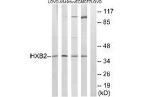 Western blot analysis of extracts from MCF-7/HuvEc/A549/LOVO cells, using HOXB2 Antibody. (HOXB2 antibody  (AA 41-90))