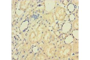Immunohistochemistry of paraffin-embedded human kidney tissue using ABIN7162611 at dilution of 1:100 (PAPPA antibody  (AA 95-302))