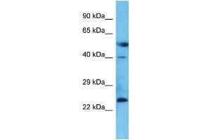 Host:  Rabbit  Target Name:  LAMP5  Sample Type:  Placenta lysates  Antibody Dilution:  1.