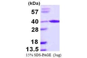 SDS-PAGE (SDS) image for Aryl Hydrocarbon Receptor Interacting Protein (AIP) (AA 1-330) protein (His tag) (ABIN667502)