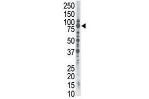 Image no. 1 for anti-SMAD Specific E3 Ubiquitin Protein Ligase 1 (SMURF1) (C-Term) antibody (ABIN357470) (SMURF1 antibody  (C-Term))