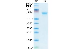 Mouses LAMP5 on Tris-Bis PAGE under reduced condition. (LAMP5 Protein (AA 30-235) (Fc Tag))