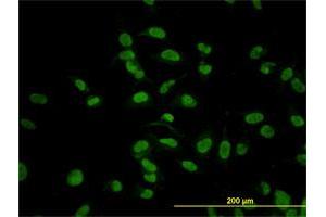 Immunofluorescence of monoclonal antibody to CMAS on HeLa cell.