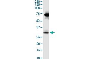 STC2 monoclonal antibody (M08), clone 2B11. (Stanniocalcin 2 antibody  (AA 1-302))