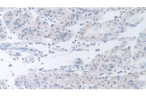 Detection of b4GALNT2 in Human Stomach Tissue using Polyclonal Antibody to Beta-1,4-N-Acetyl Galactosaminyl Transferase 2 (b4GALNT2) (B4GALNT2 antibody  (AA 324-566))