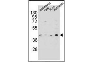 Western blot analysis of HHLA2 Antibody (N-term) in MDA-MB453, CEM, HL-60, MDA-MB231 cell line lysates (35ug/lane). (HHLA2 antibody  (N-Term))