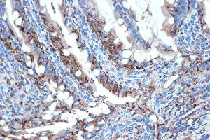 Immunohistochemistry of paraffin-embedded rat intestine using FABPI Rabbit mAb (ABIN7267151) at dilution of 1:100 (40x lens). (FABP2 antibody)