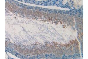 Detection of CHRM1 in Rat Testis Tissue using Polyclonal Antibody to Cholinergic Receptor, Muscarinic 1 (CHRM1) (CHRM1 antibody  (AA 210-363))