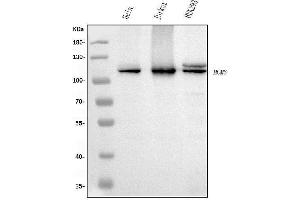 Western blot analysis of MCM6 using anti-MCM6 antibody (ABIN7600036).