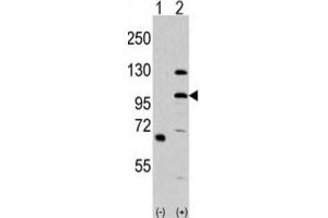Western Blotting (WB) image for anti-Mitogen-Activated Protein Kinase Kinase Kinase MLK4 (KIAA1804) antibody (ABIN3003622) (MLK4 antibody)