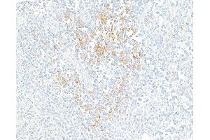 Immunohistochemistry (IHC) image for anti-CD274 (PD-L1) (C-Term) antibody (ABIN7454042)
