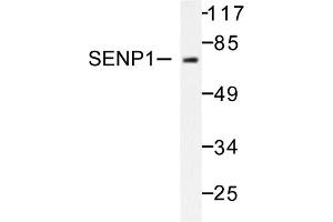 Image no. 1 for anti-SUMO1/sentrin Specific Peptidase 1 (SENP1) antibody (ABIN271955) (SENP1 antibody)