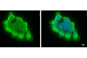 ICC/IF Image TRIF antibody [C3], C-term detects TRIF protein at cytosol by immunofluorescent analysis. (TICAM1 antibody  (C-Term))
