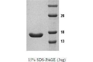 Figure annotation denotes ug of protein loaded and % gel used. (TNF alpha Protein)