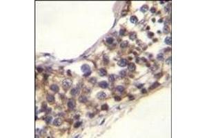 PNLDC1 Antibody (C-term) (ABIN655332 and ABIN2844899) immunohistochemistry analysis in formalin fixed and paraffin embedded human testis tissue followed by peroxidase conjugation of the secondary antibody and DAB staining. (PNLDC1 antibody  (C-Term))