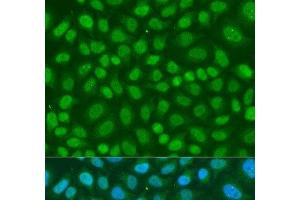 Immunofluorescence analysis of U2OS cells using TAF11 Polyclonal Antibody at dilution of 1:100. (TAF11 antibody)