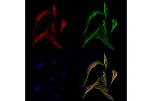 ABIN6259350 and ABIN6275567 staining 3 by IF/ICC. (SH3GLB2 antibody  (C-Term))