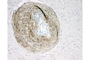 Anti-Calponin antibody, IHC(P) IHC(P): Human Placenta Tissue (CNN1 antibody  (C-Term))