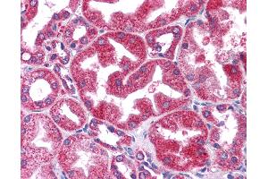 Anti-STAT3 antibody IHC of human kidney.