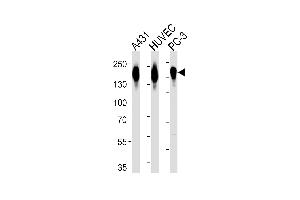 Western blot analysis of lysates from A431, HUVEC, PC-3 cell line (from left to right), using EGFR Antibody (p) (ABIN651628 and ABIN2840334). (EGFR antibody  (C-Term))