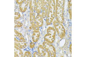 Immunohistochemistry of paraffin-embedded Mouse kidney using Parkin antibody  at dilution of 1:100 (40x lens).