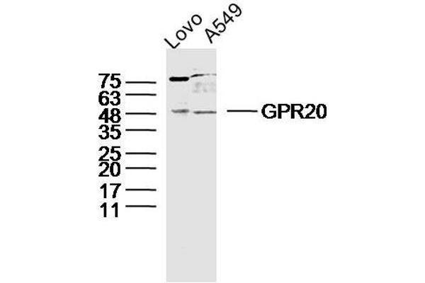 GPR20 antibody  (AA 51-150)