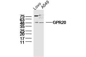Lane 1: LOVO lysates Lane 2: A549 lysates probed with GPR20 Polyclonal Antibody, Unconjugated  at 1:300 dilution and 4˚C overnight incubation. (GPR20 antibody  (AA 51-150))