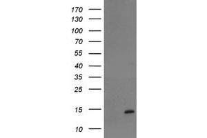 Image no. 1 for anti-TP53RK Binding Protein (TPRKB) antibody (ABIN1501485) (TPRKB antibody)
