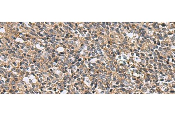 EARS2 antibody