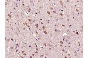 Paraformaldehyde-fixed, paraffin embedded Mouse brain Antigen retrieval by boiling in sodium citrate buffer (pH6. (IMMT antibody  (AA 241-340))