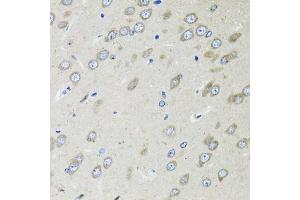 Immunohistochemistry of paraffin-embedded rat brain using OGDH antibody (ABIN6131413, ABIN6145002, ABIN6145004 and ABIN6216119) at dilution of 1:100 (40x lens). (alpha KGDHC antibody  (AA 148-427))