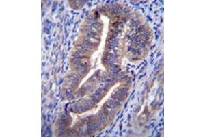 Immunohistochemistry analysis in formalin fixed and paraffin embedded human uterus tissue reacted with KIAA1324 / EIG121 Antibody (C-term) Cat. (ELAPOR1 antibody  (C-Term))