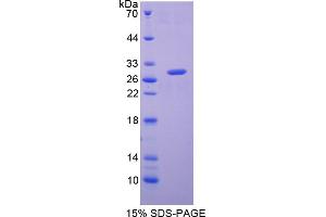 Image no. 1 for Glutathione S-Transferase alpha 2 (GSTa2) (AA 1-222) protein (His tag) (ABIN6238026)