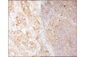 Immunohistochemistry (IHC) image for anti-Eukaryotic Translation Elongation Factor 2 (EEF2) (AA 808-858) antibody (ABIN7454538) (EEF2 antibody  (AA 808-858))