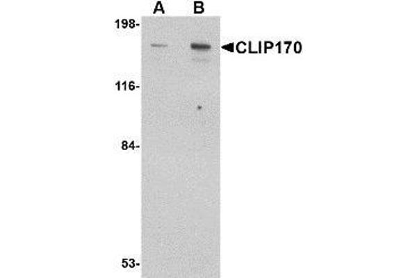 CABS1 Antikörper  (C-Term)