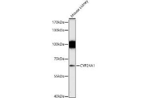Western blot analysis of extracts of Mouse kidney, using CYP24 antibody (805) at 1:1000 dilution.