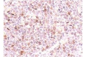 Immunohistochemistry (IHC) image for anti-Cyclin-Dependent Kinase Inhibitor 2D (p19, Inhibits CDK4) (CDKN2D) antibody (ABIN487338) (CDKN2D antibody)