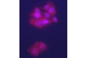 Immunofluorecence staining of GPC3 polyclonal antibody  on HepG2 cells . (Glypican 3 antibody  (N-Term))